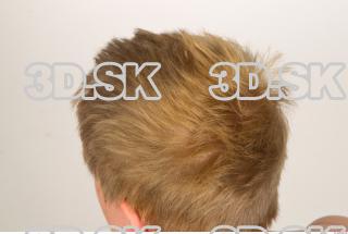 Hair texture of Pat 0008